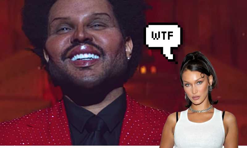 The weeknd: почему артист решается на пластическую операцию?