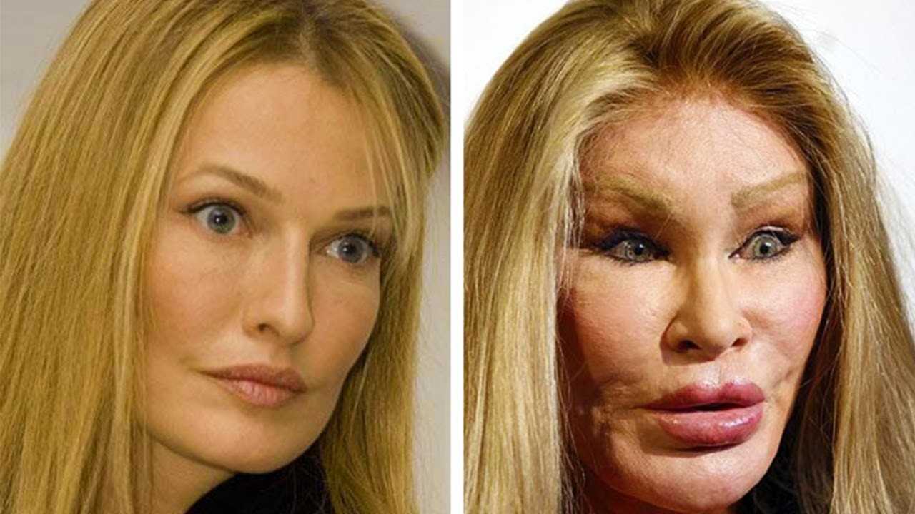 12 фанатов, которые так сильно полюбили своих кумиров, что стали их копиями с помощью пластической хирургии